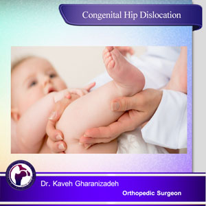 congenital hip dislocation 
